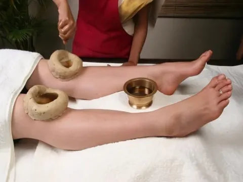 Person receiving cupping therapy with traditional cups on their legs.
